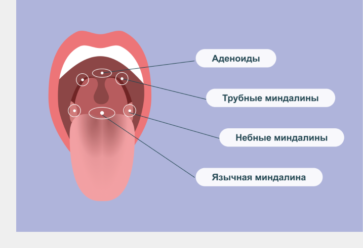 Бывают ли осложнения